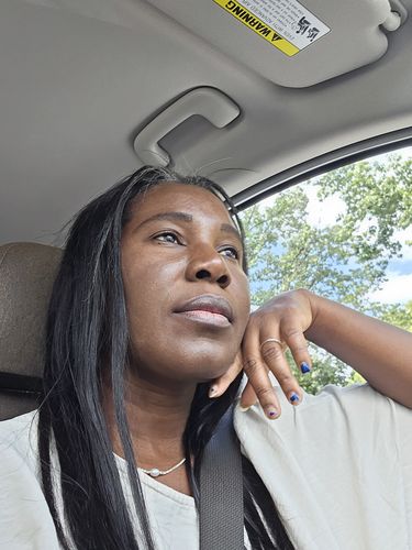 Customer photo review of Fair and White Exclusive Gel Cream with Vitamin "C" 30 ml / 1 fl oz