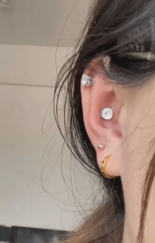 Customer photo review of SlimEdge™ DiamondCut LymphDetox Magnetherapy Earrings（Limited Time Discount 🔥 Last Day）