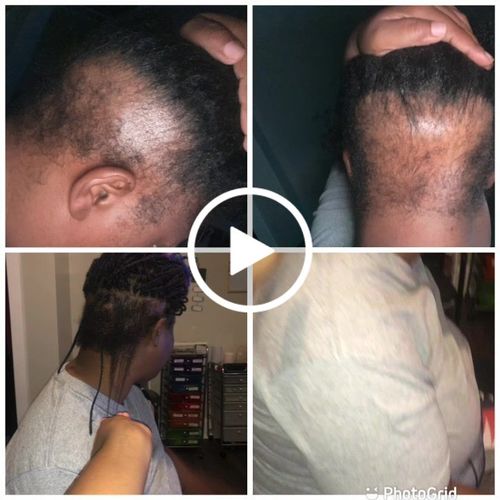 Customer video review of BALM- Stimulating Scalp and Hair Balm