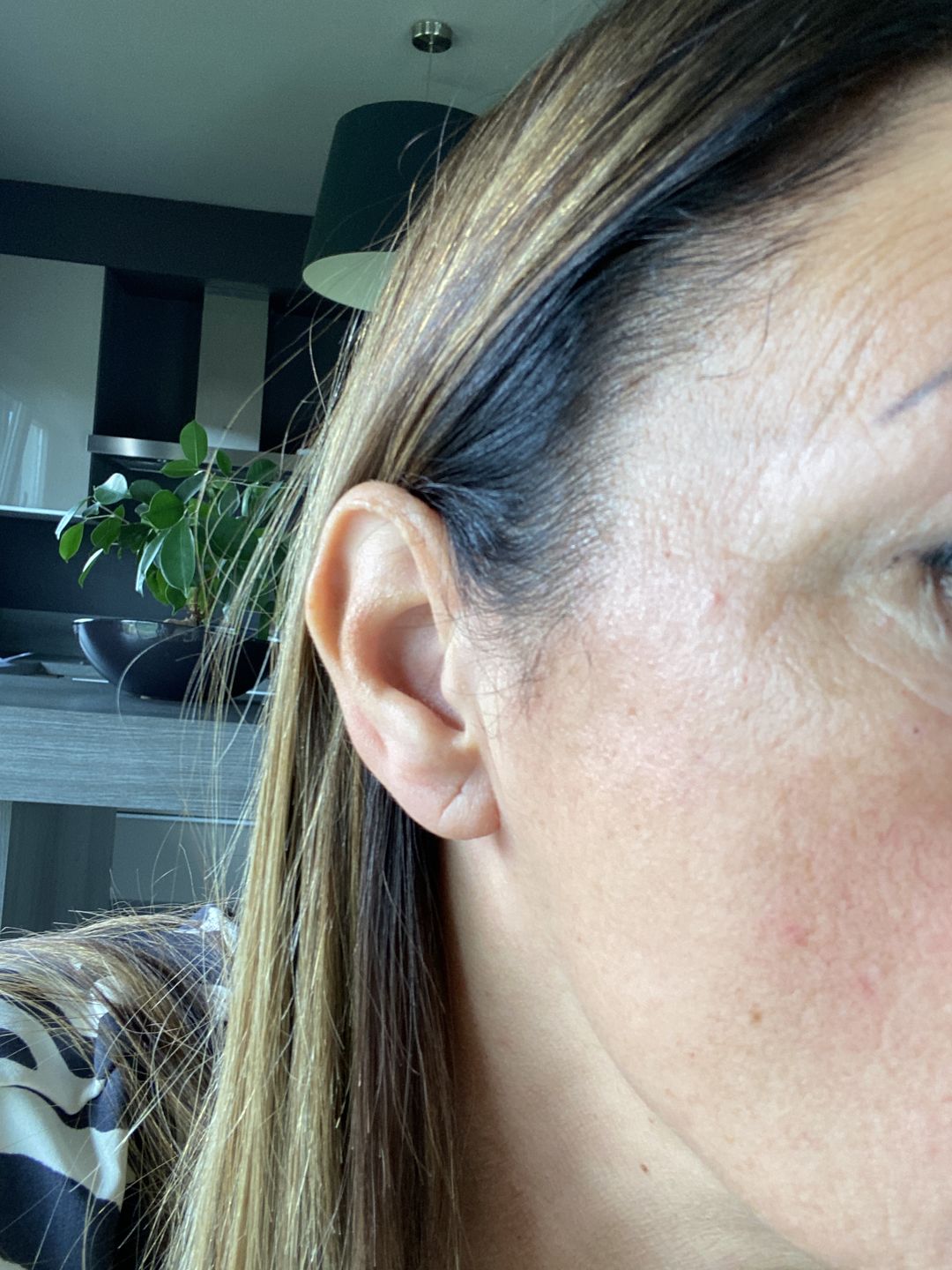 Customer photo review of Good Skin - 3 mois