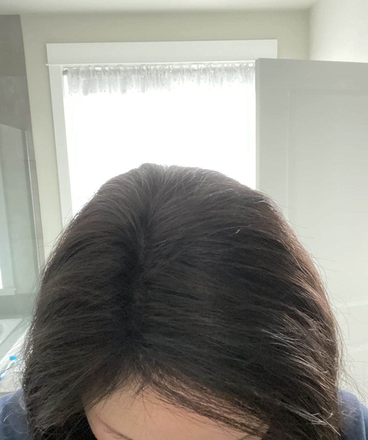 Customer photo review of Human Hair Toppers for Women Real Hair Remy Hair Toppers Black #1B