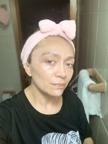 Customer photo review of KIT SUEROS FACIALES DÍA Y NOCHE CON CÉLULAS MADRE, COLÁGENO Y ÁCIDO HIALURÓNICO.