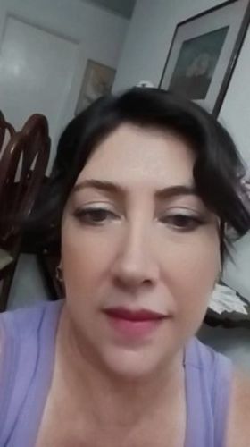 Customer photo review of KIT SUEROS FACIALES DÍA Y NOCHE CON CÉLULAS MADRE, COLÁGENO Y ÁCIDO HIALURÓNICO.