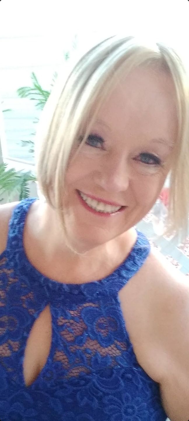 Customer photo review of Hair Topper for Thinning Crown Mono Base Lightest Blonde #60