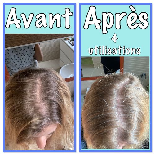 Customer photo review of OFFRE SOLDES D'ÉTÉ - Notre soin éclaircissant pour des cheveux rayonnants en moins de 5 minutes