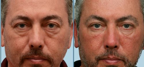 Customer photo review of Eye Repair Stick