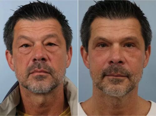 Customer photo review of Eye Repair Stick