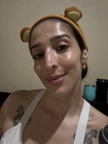 Customer photo review of Retinol 0.2% in Squalane