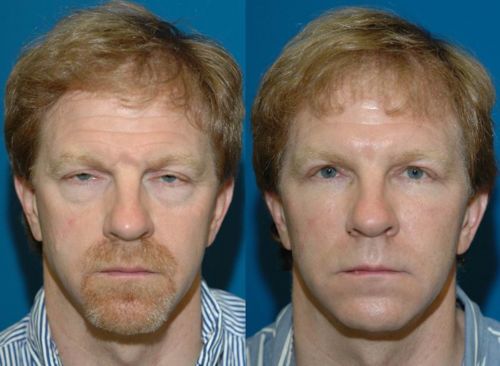 Customer photo review of Eye Repair Stick