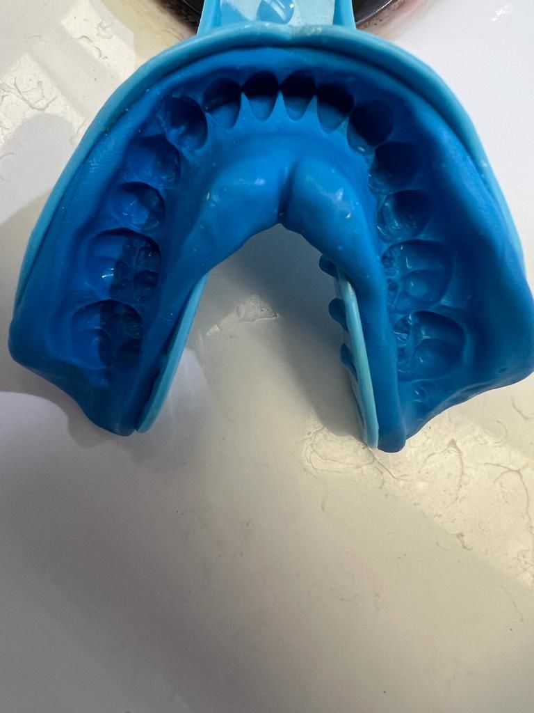 Customer photo review of 3mm Soft Durable Night Guard for Heavy Teeth Grinding/Clenching- Strong Protection with All-Night Comfort