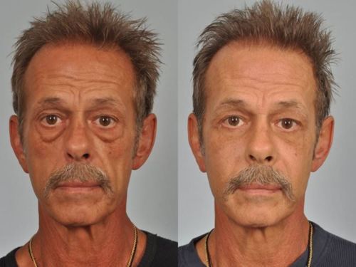 Customer photo review of Eye Repair Stick