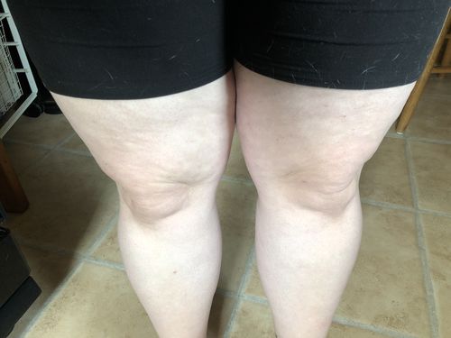 Customer photo review of Buy 3 Uric Acid Support Capsules, Get A Free Travel Straw