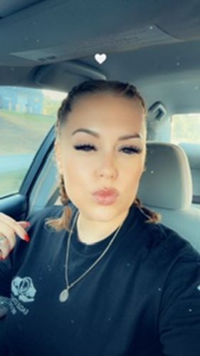 Customer photo review of Extra Strength Hair Regrowth Serum Bundle (2oz)