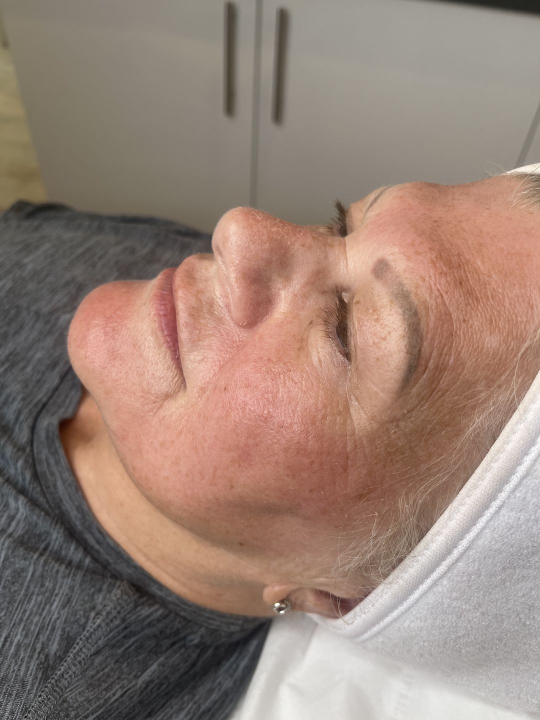 Customer photo review of WOW fusion® Device