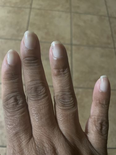 Customer photo review of Rocket Nail Fuel Nail Repair - Clear