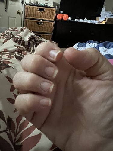 Customer photo review of The Nail System