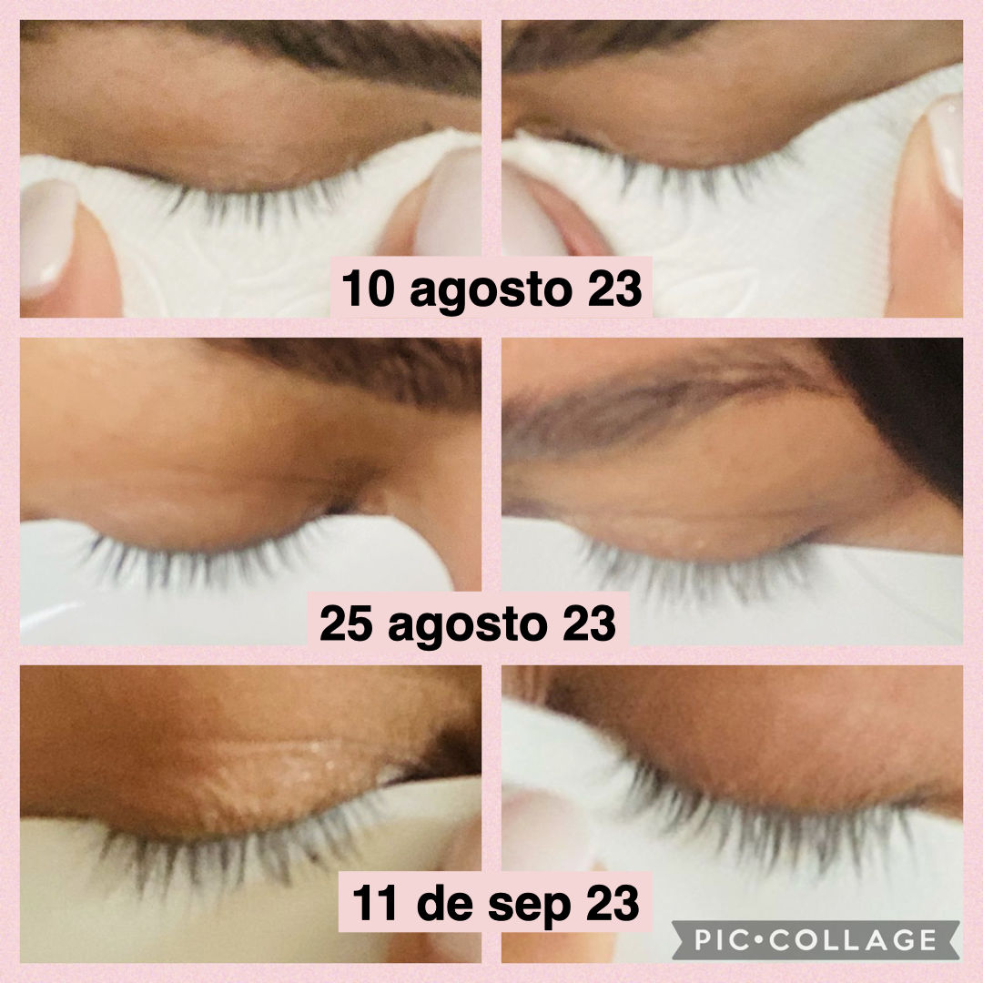 Customer photo review of CS EYELASH - Suero para crecimiento de pestañas y cejas