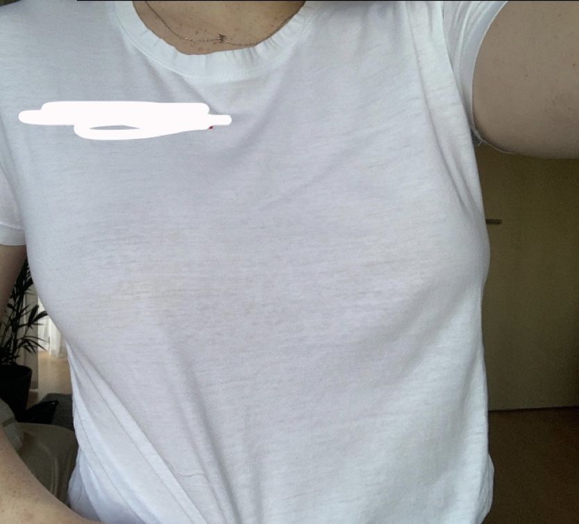 Customer photo review of 4er Mix Pack Nippelcover selbsthaftend + mit Kleber