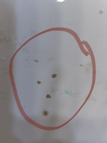 Customer photo review of Water Flosser