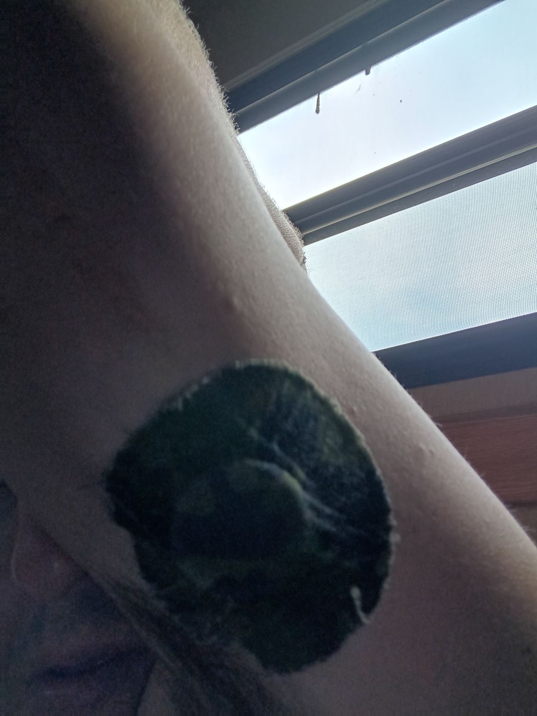 Customer photo review of Skin Grip Original - Freestyle Libre Adhesive Patches