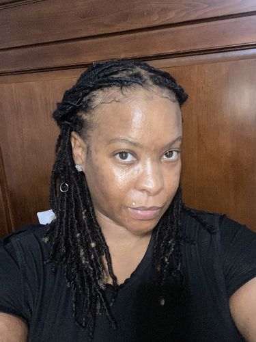 Customer photo review of BERRI-CLEAR+ 5 BERRY SUPERFRUIT SERUM