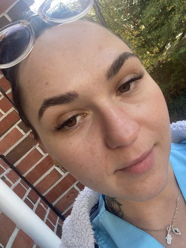 Customer photo review of Tranquilizing Eye Cream