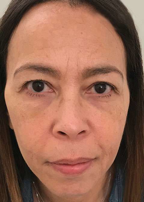 Customer photo review of Tranquilizing Eye Cream