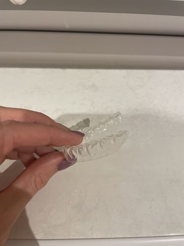 Customer photo review of SleepPro Slimline Night Guard 1.5mm