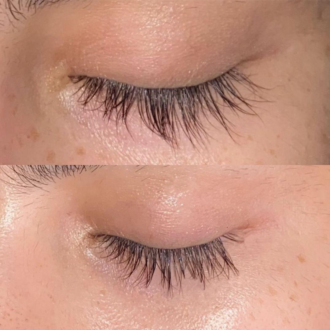 Customer photo review of CS EYELASH - Suero para crecimiento de pestañas y cejas