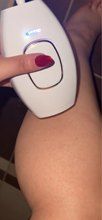 Customer photo review of GLIMORA®  - IPL Haarentfernung