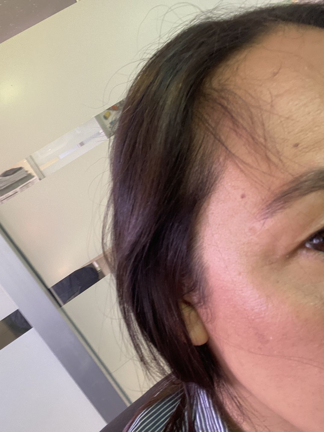 Customer photo review of HAIRtamin Fórmula Avanzada