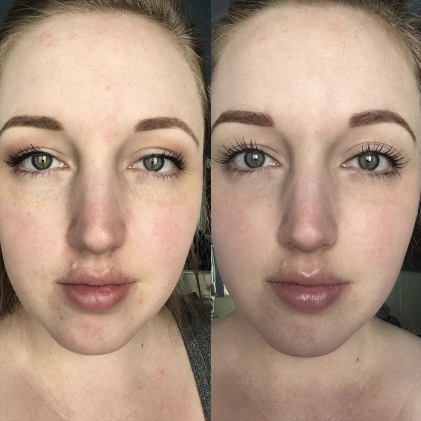 Customer photo review of Tranquilizing Eye Cream