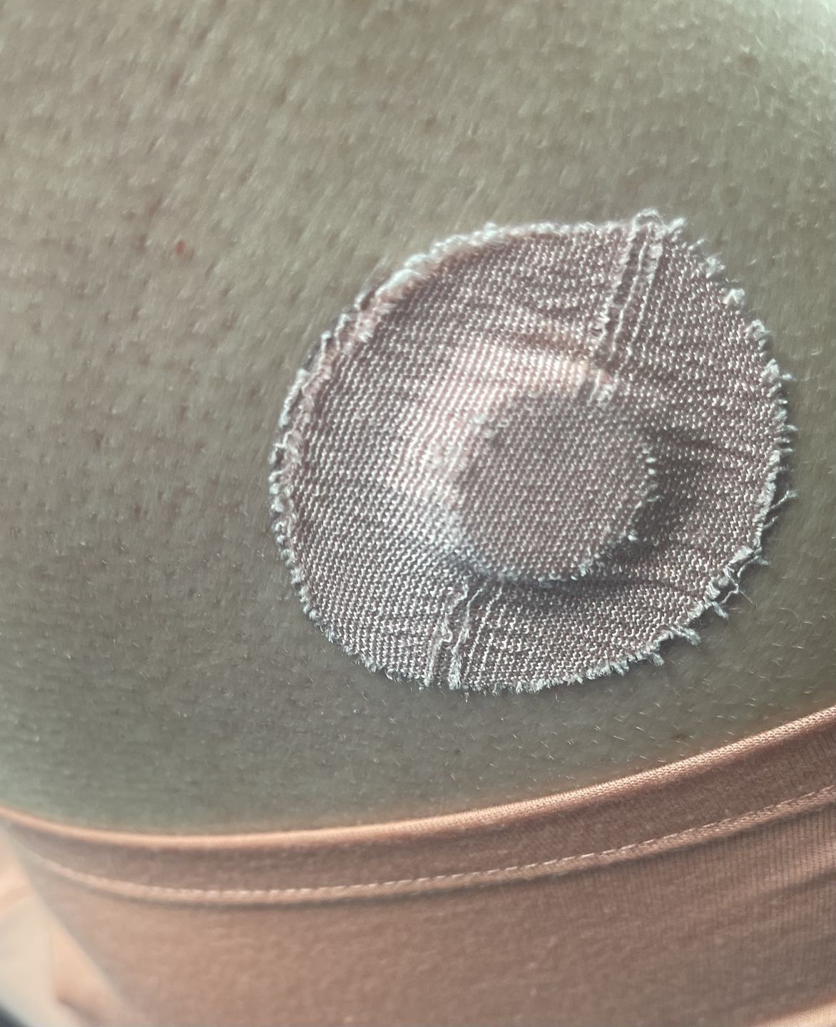 Customer photo review of Skin Grip Original - Freestyle Libre 3 Adhesive Patches