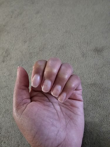 Customer photo review of The Nail System