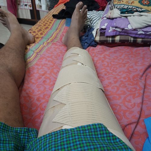 Customer photo review of Knee Brace - Long (19" Brace) | Ideal firm Knee support that limits knee motion & stabilizes the knee with mediolateral metal supports | Color - Beige