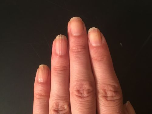 Customer photo review of Rocket Nail Fuel Nail Repair - Clear