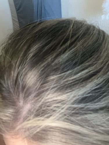 Customer photo review of Day After Brush Clean Dry Shampoo