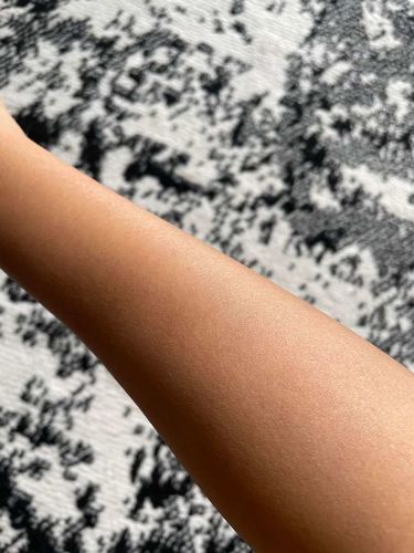 Customer photo review of IPL Pro - Permanent Hårfjerner