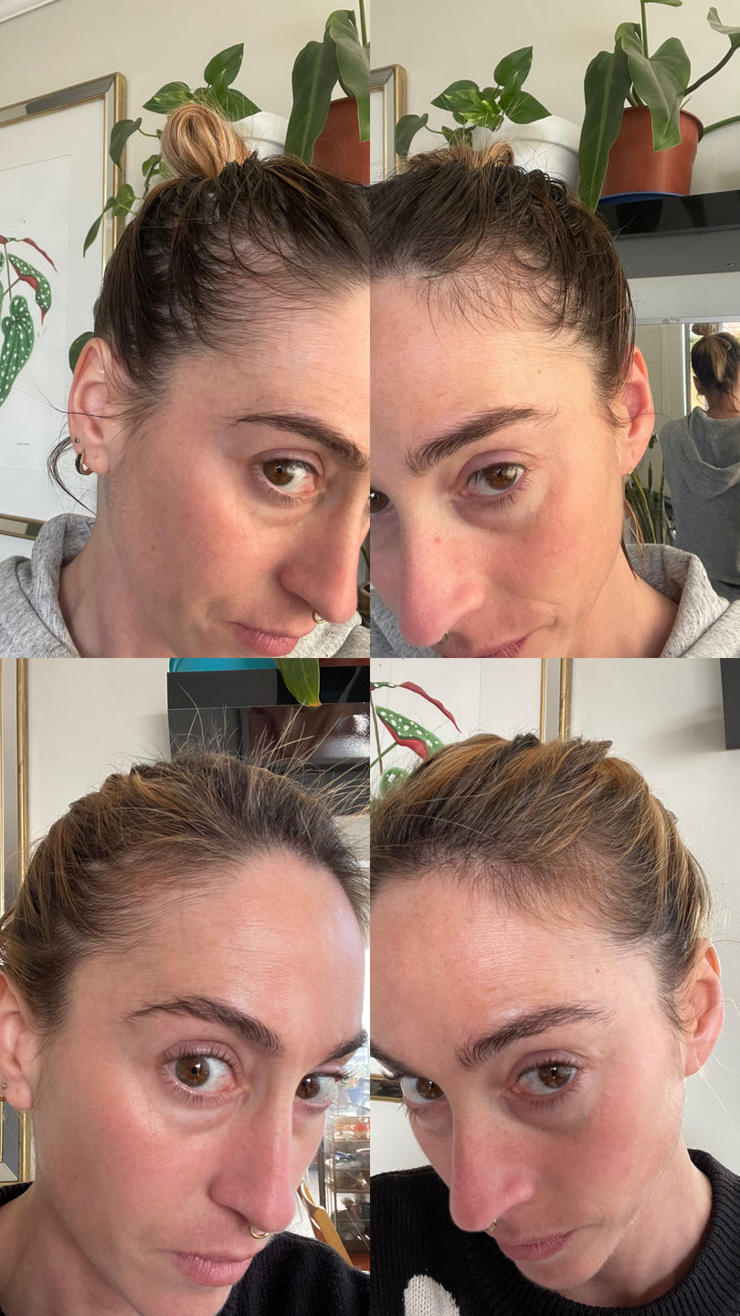 Customer photo review of Kit Anticaída Shampoo en barra + Tónico