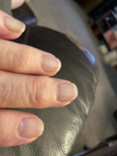Customer photo review of Rocket Nail Fuel Nail Repair - Clear