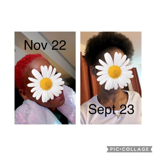 Customer photo review of Rice Oil Scalp Boost