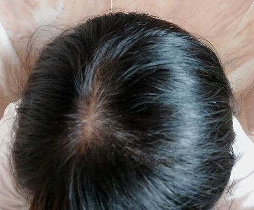 undefined review of [Limited Time Deal] Plantur 39 Colour Brown Hairfall Complete Set image 1 out of 1