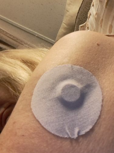 Customer photo review of Skin Grip Original - Freestyle Libre Adhesive Patches