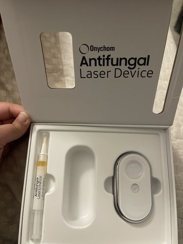 Customer photo review of Onychom - Antifungal Laser Device