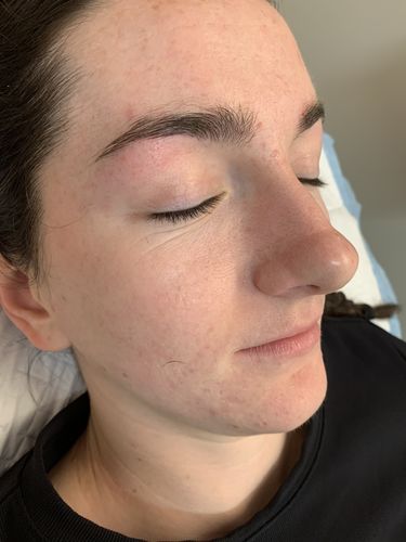Customer photo review of Femvy LED Light Therapy Pod