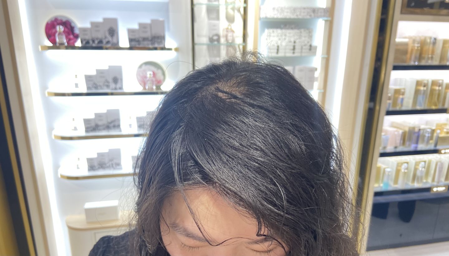 Customer photo review of [IN] YOUTH Cure Anti-Chute Cheveux
