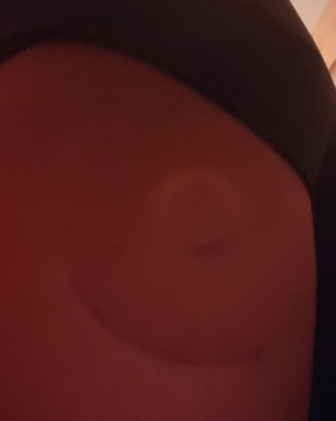 Customer photo review of Skin Grip Original - Freestyle Libre Adhesive Patches