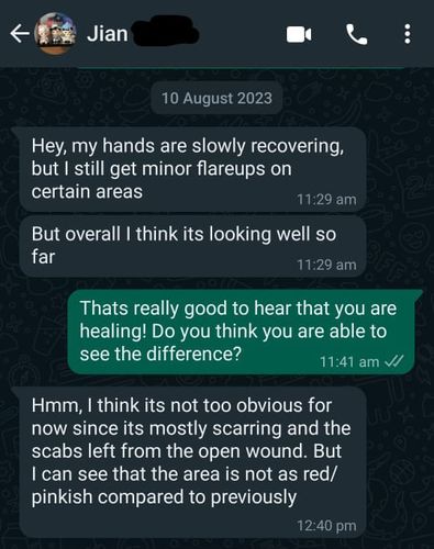 Customer photo review of Eczema Scratch Mitten