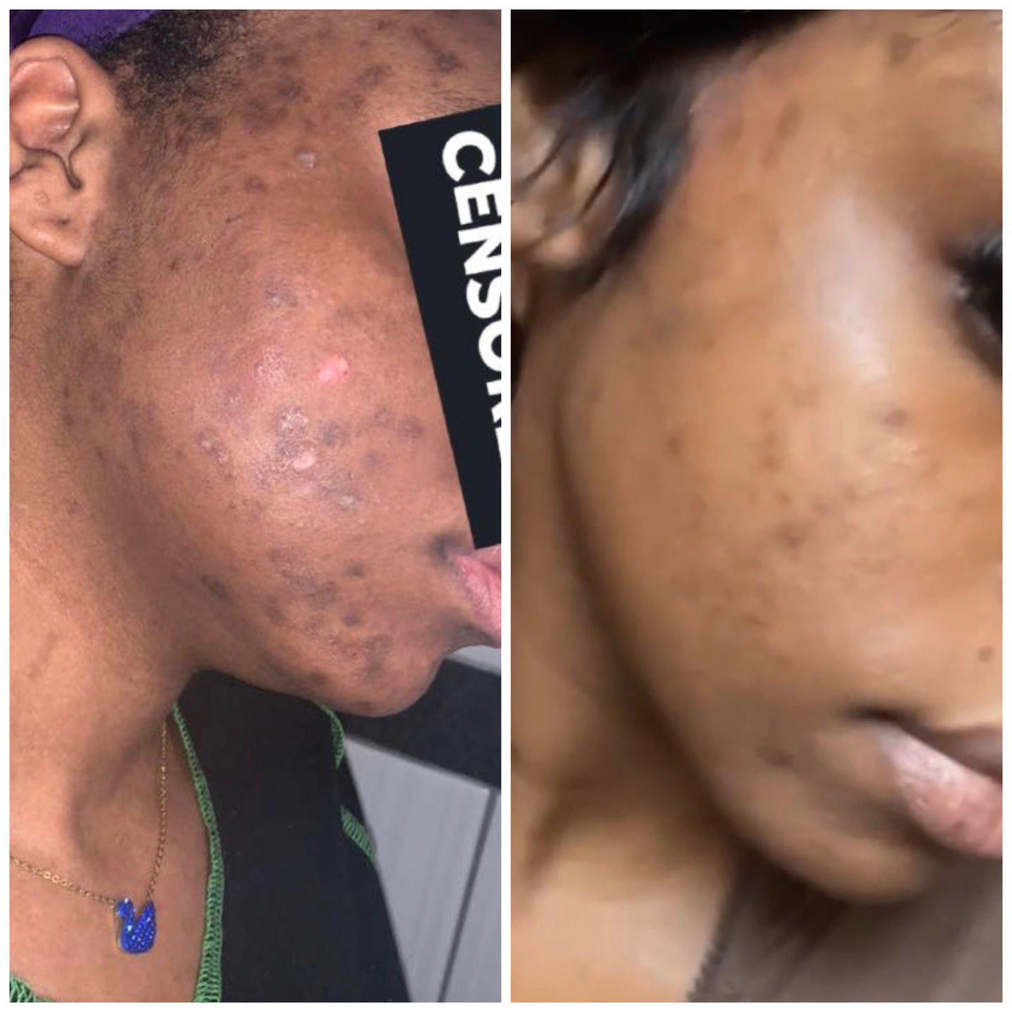 Customer photo review of Serum glow oil