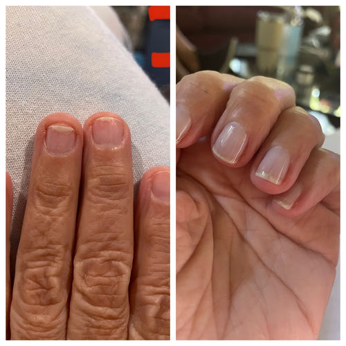 Customer photo review of Rocket Nail Fuel Nail Repair - Clear